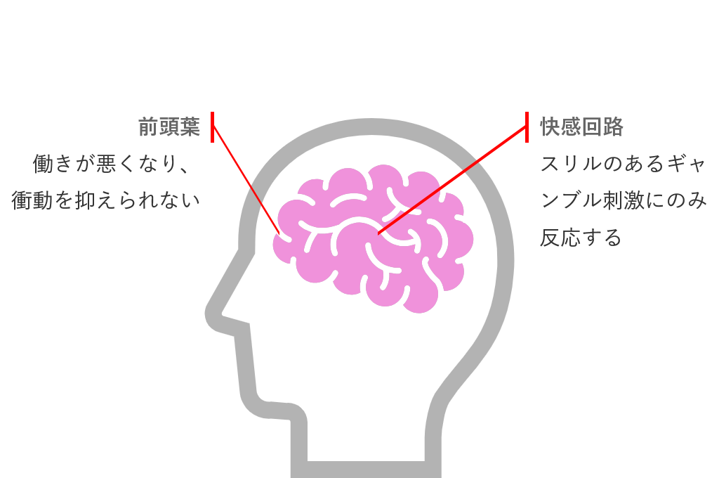 ギャンブル依存症患者の脳内